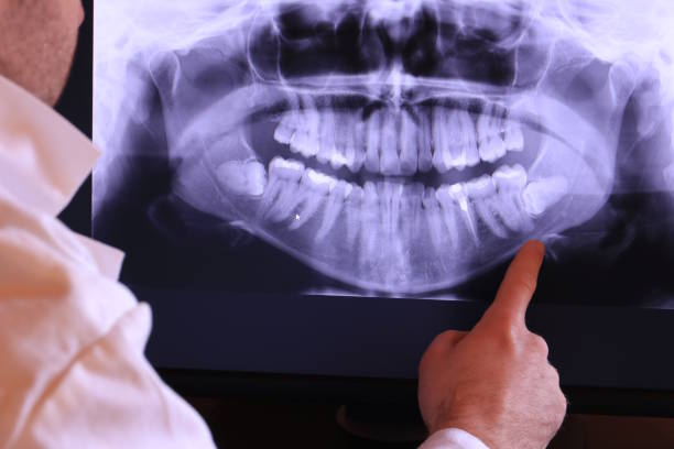 Best Emergency Dental Services for Seniors in Richton Park, IL