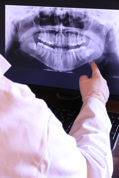 Best Emergency Dental Care for Abscessed Tooth in Richton Park, IL