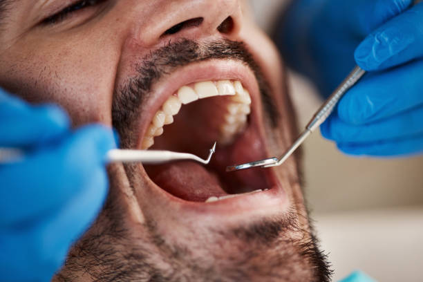 Best Emergency Root Canal Treatment in Richton Park, IL