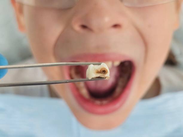 Best Pediatric Emergency Dentist in Richton Park, IL