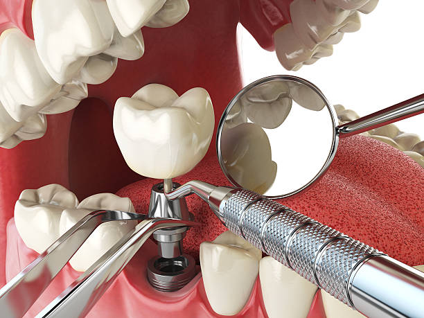 Best Weekend Emergency Dentist in Richton Park, IL